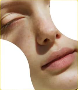 Portrait detail: skin in daylight